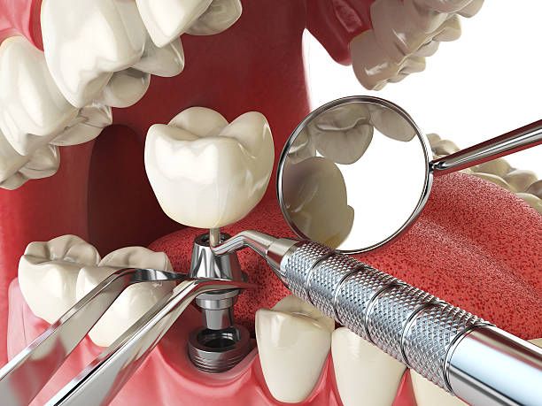Best Emergency Root Canal Treatment in Navajo, NM